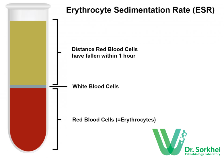 erythrocyte-sedimentation-rate-esr