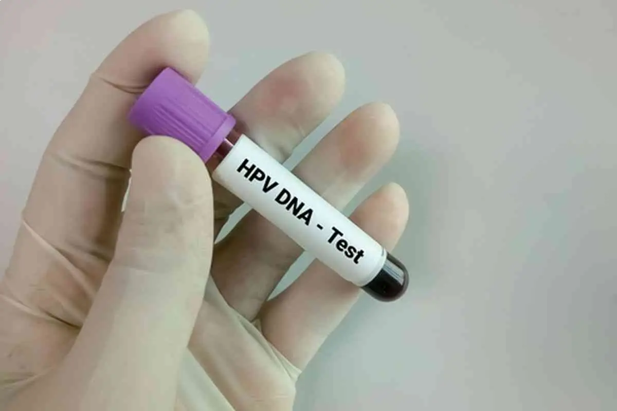 تست hpv