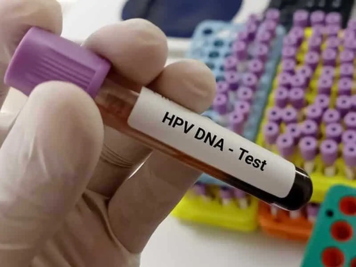 تست hpv