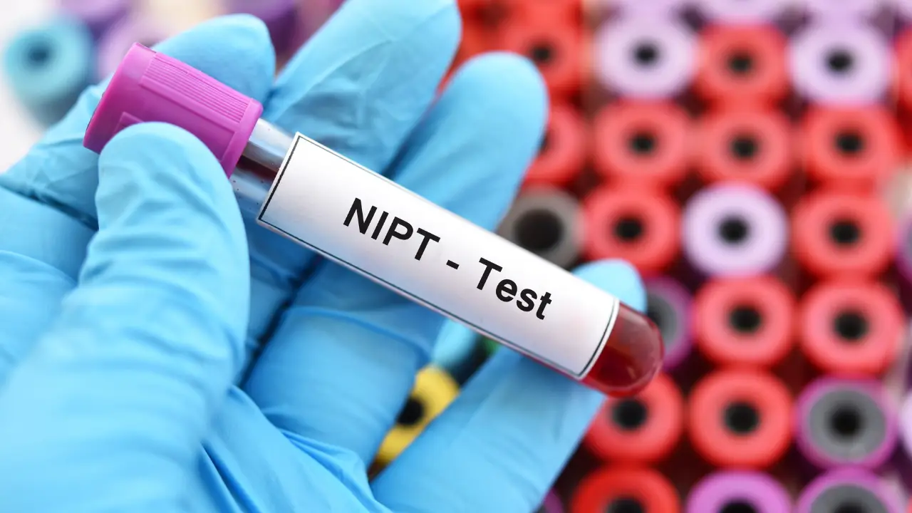 هزینه آزمایش nipt
