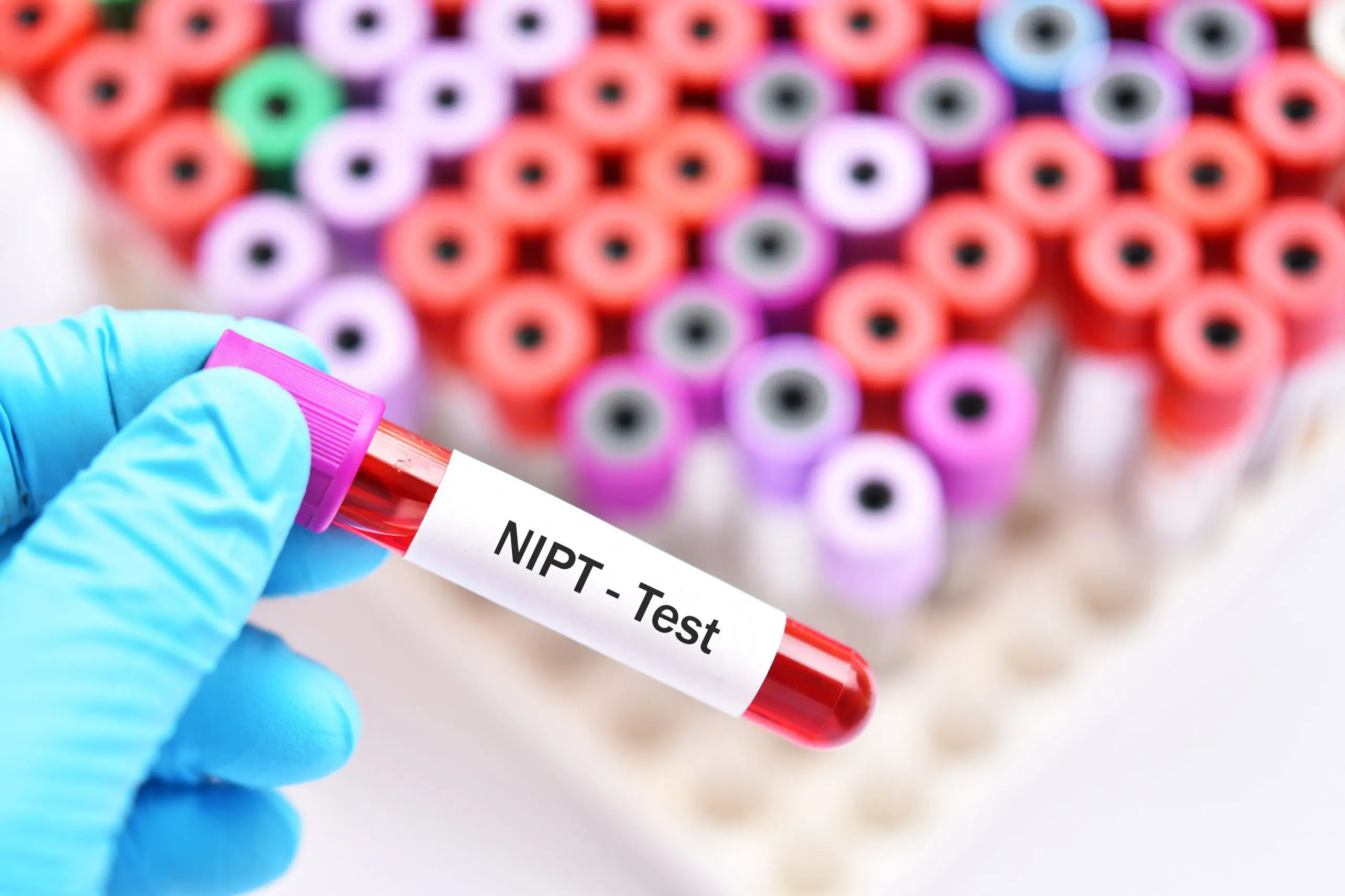 هزینه آزمایش nipt