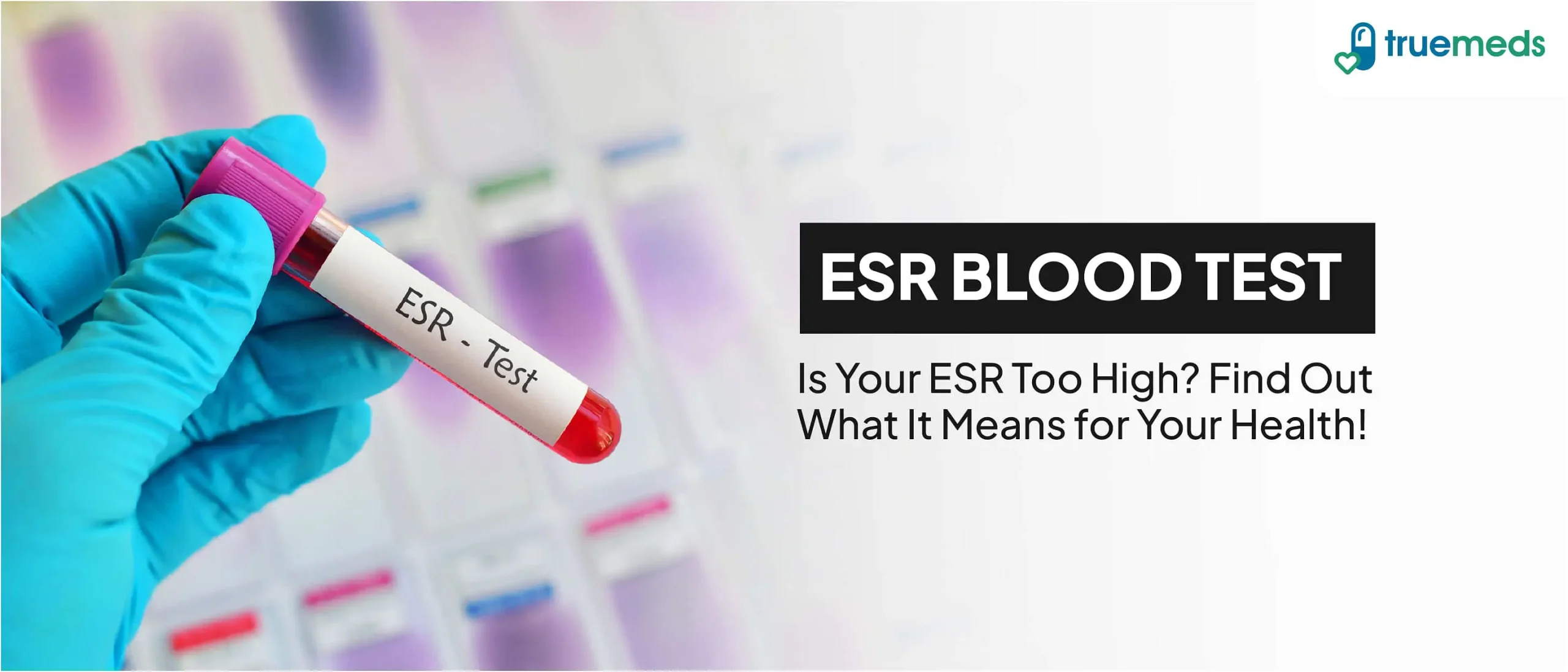 esr در آزمایش خون