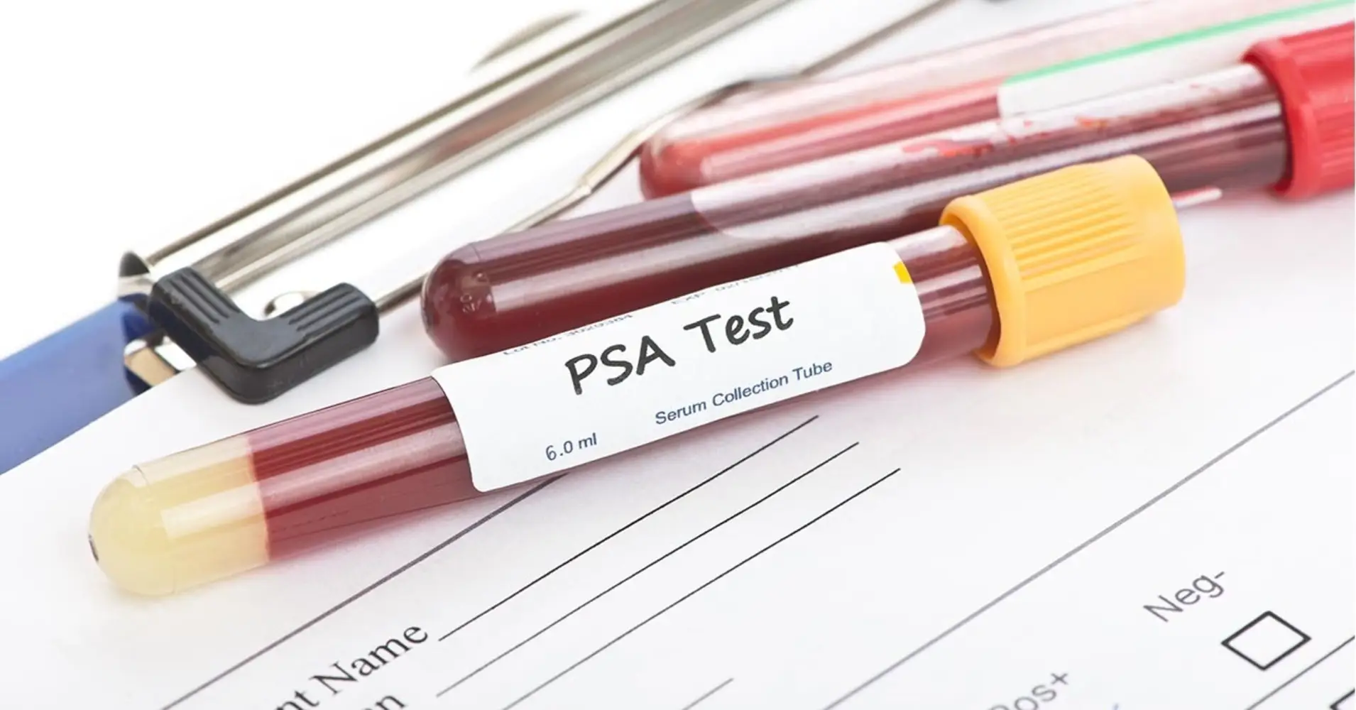 آزمایش psa برای پروستات