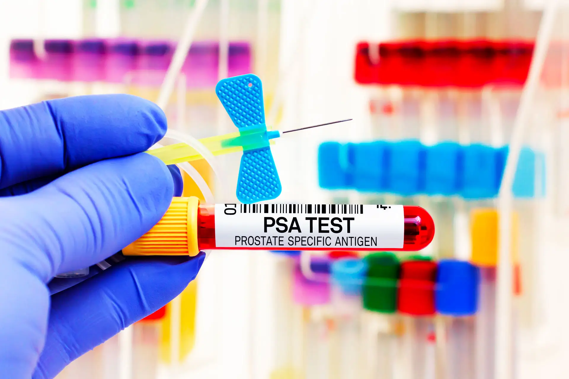 آزمایش psa برای پروستات