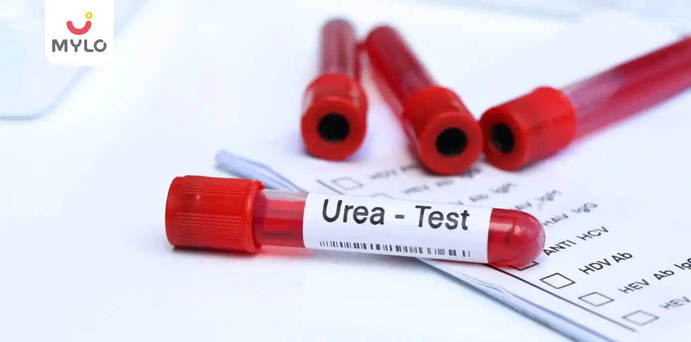 بالا بودن urea در آزمایش خون