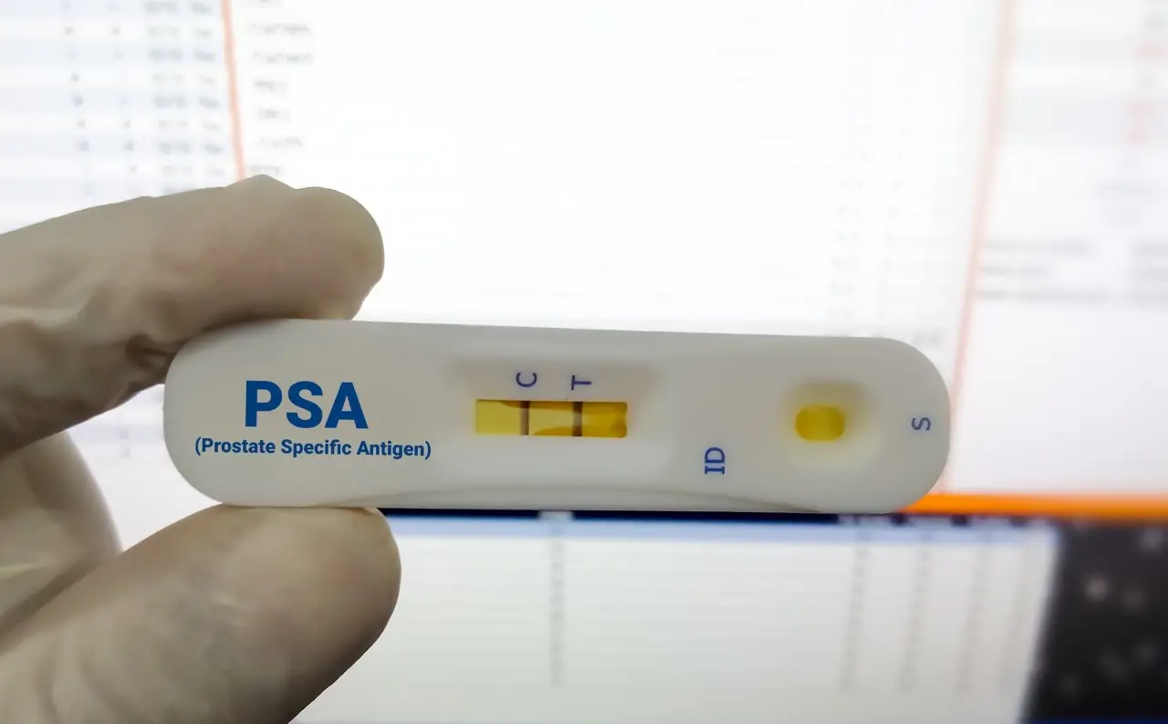 آزمایش psa برای پروستات